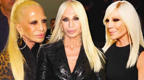 donatella versace d& 39|donatella versace face what happened.